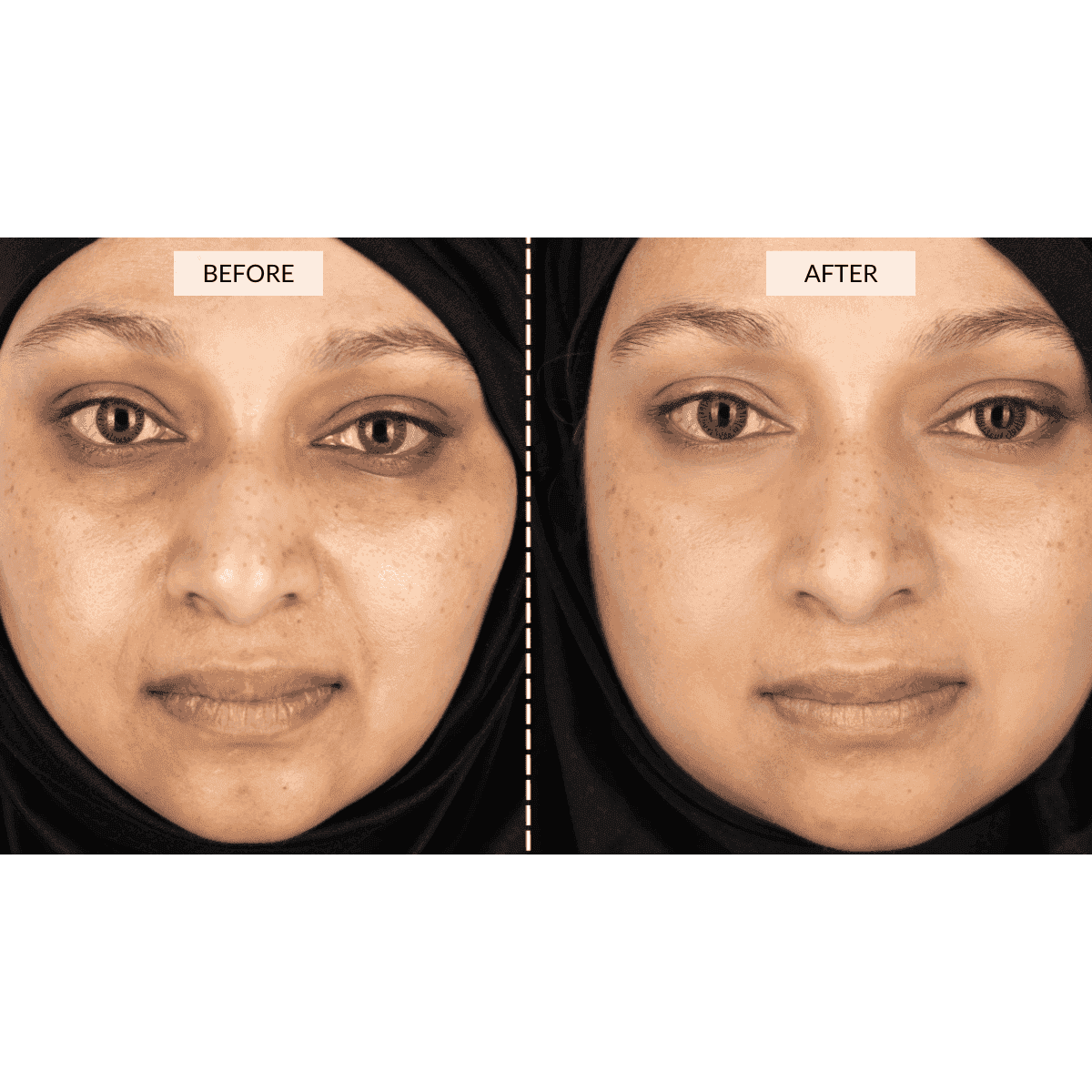 RETURNS - CurrentBody Skin Face & Neck Kit
